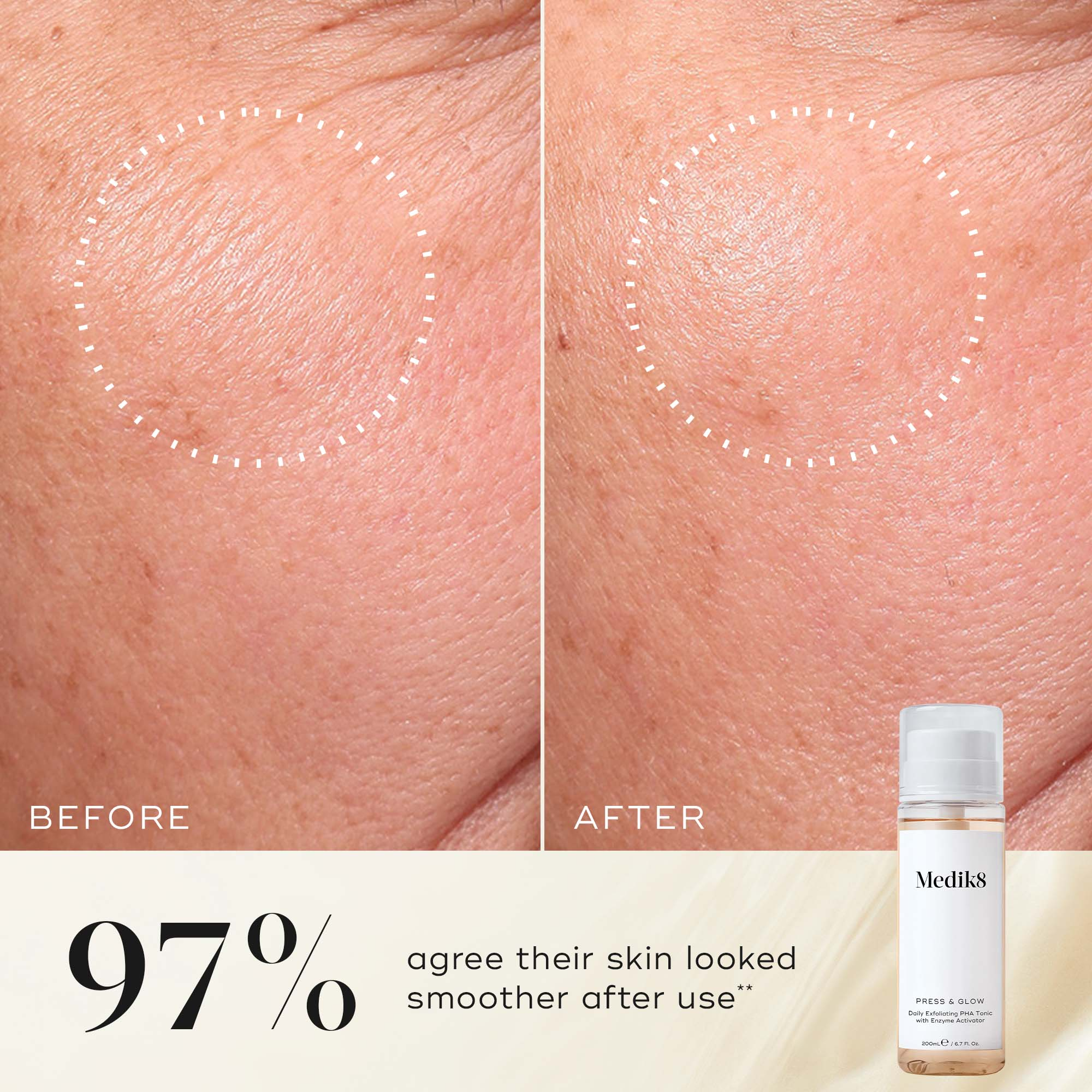 Press & Glow® – Daily Exfoliating Toner