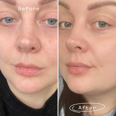 Rosehip Regenerating Face Oil