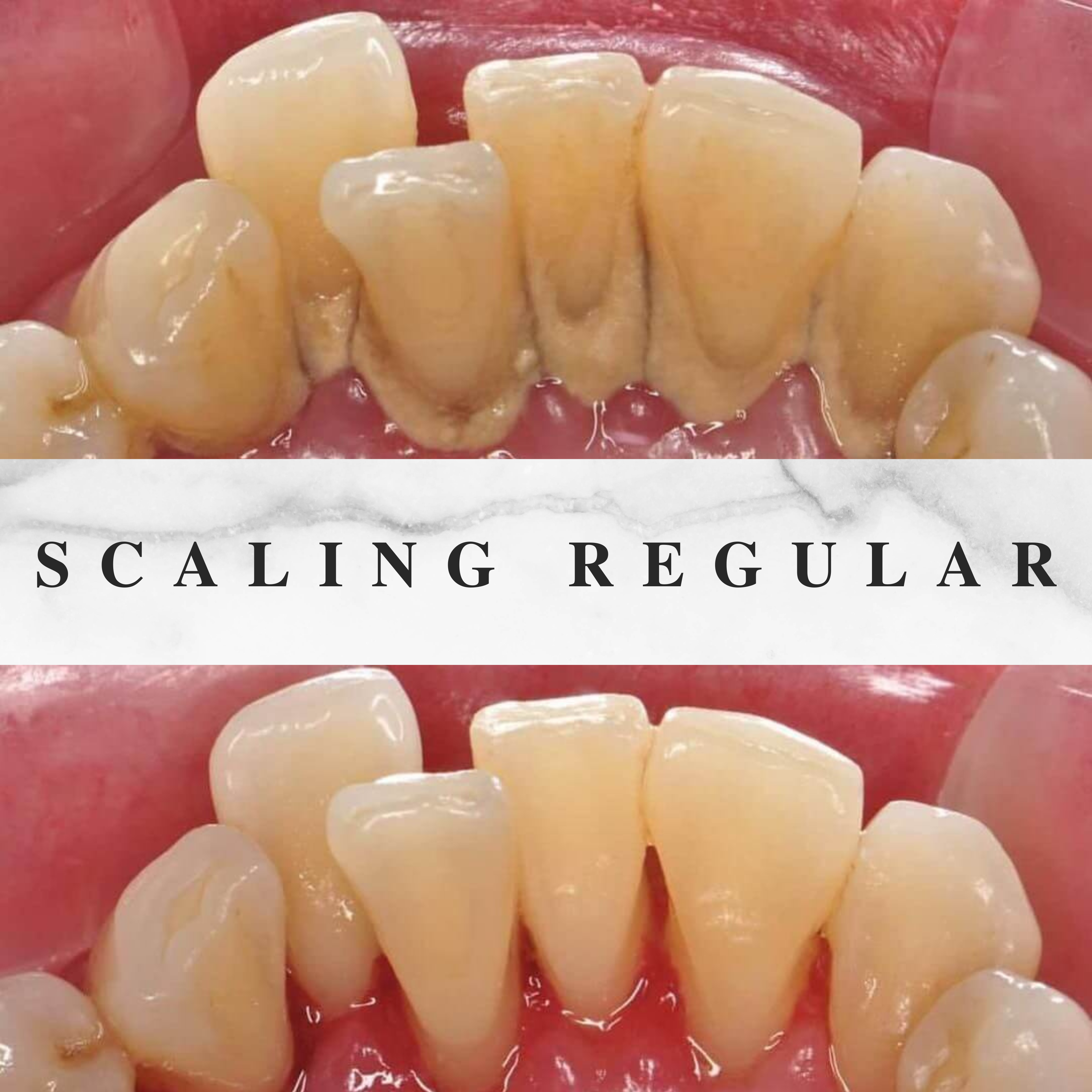 Scaling Regular