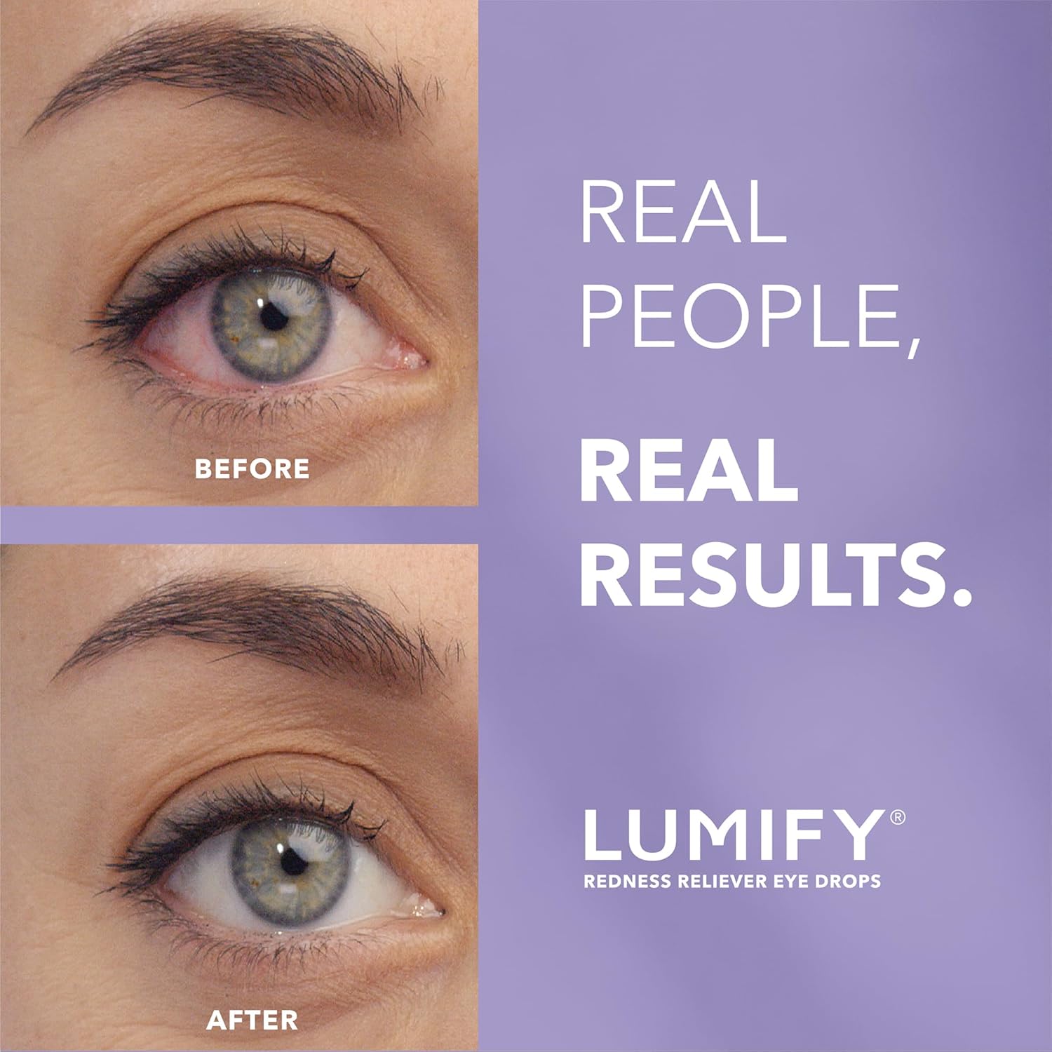 LUMIFY Redness Reliever Eye Drops, for Whiter & Brighter Looking Eyes