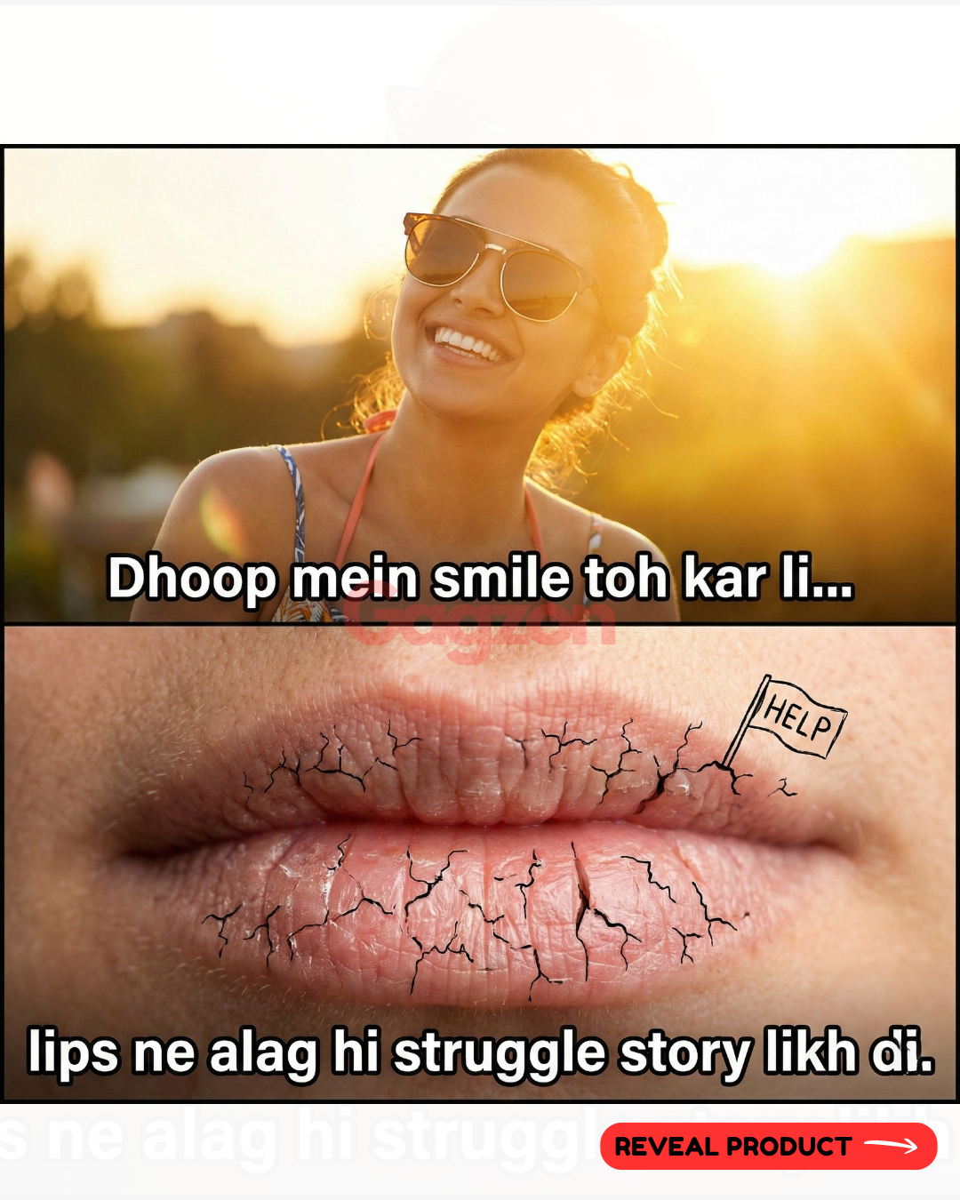 When your lips get zero SPF but full sun trauma