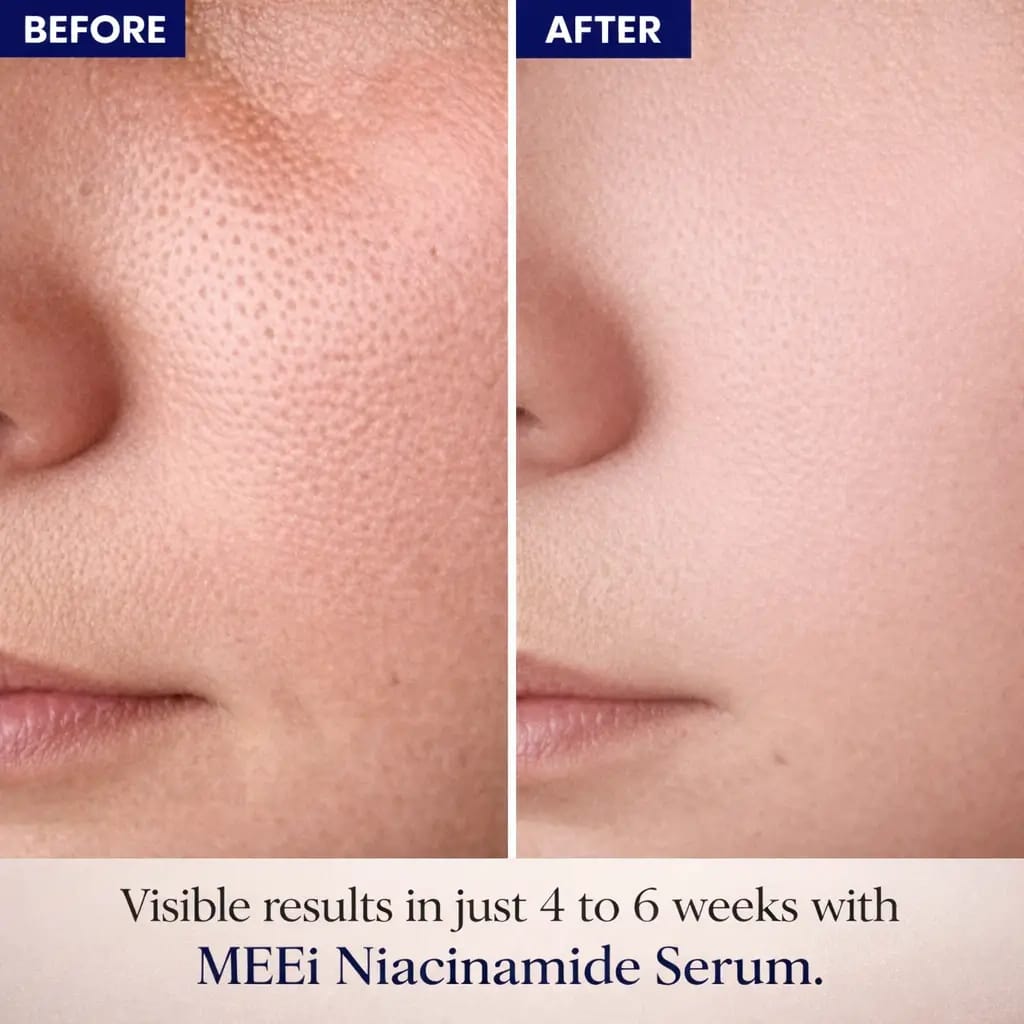 MEEi Niacinamide 10% + Zinc Pca 1%  