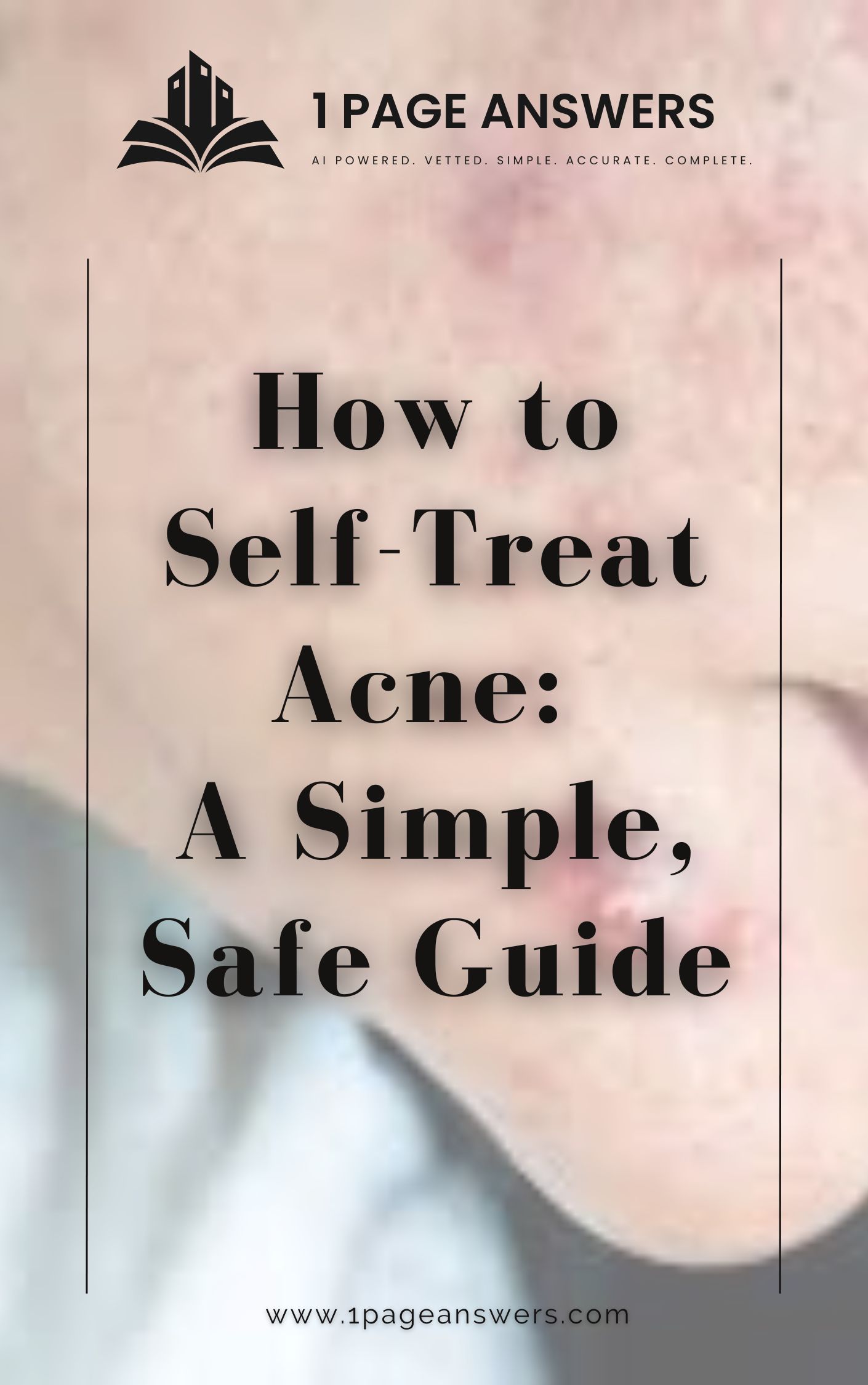 How to Self-Treat Acne