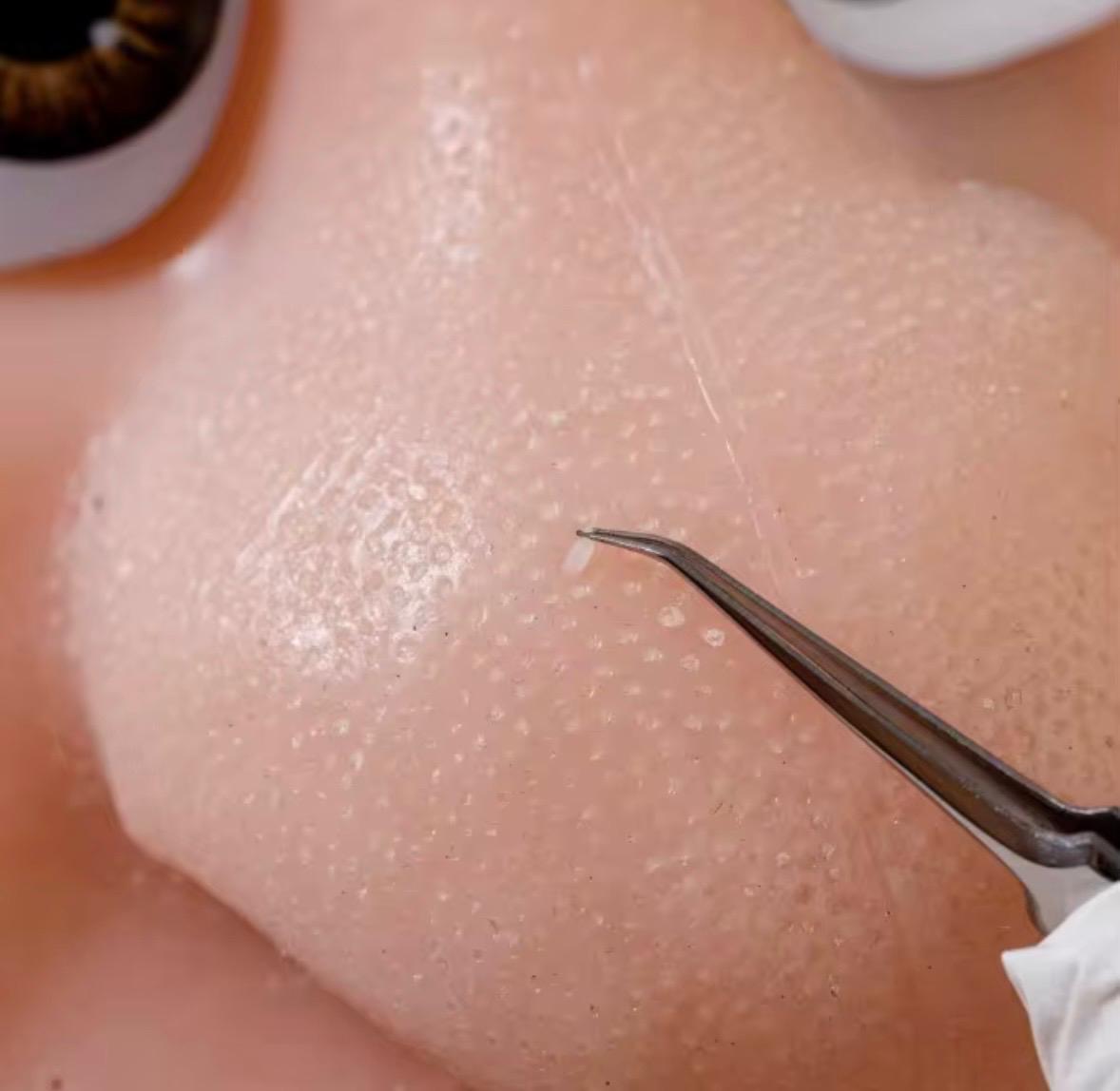 PopDaddy - Pimple Popping Fidget Toy Kit (Include 1 refill Pack)