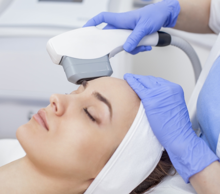 Láser IPL · Manchas, Textura, Acné y Arañas Vasculares