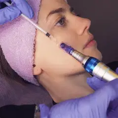 Dermapen · Renovación y regeneración de la piel