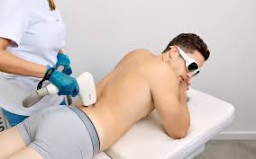 LÁSER CUERPO COMPLETO HOMBRE