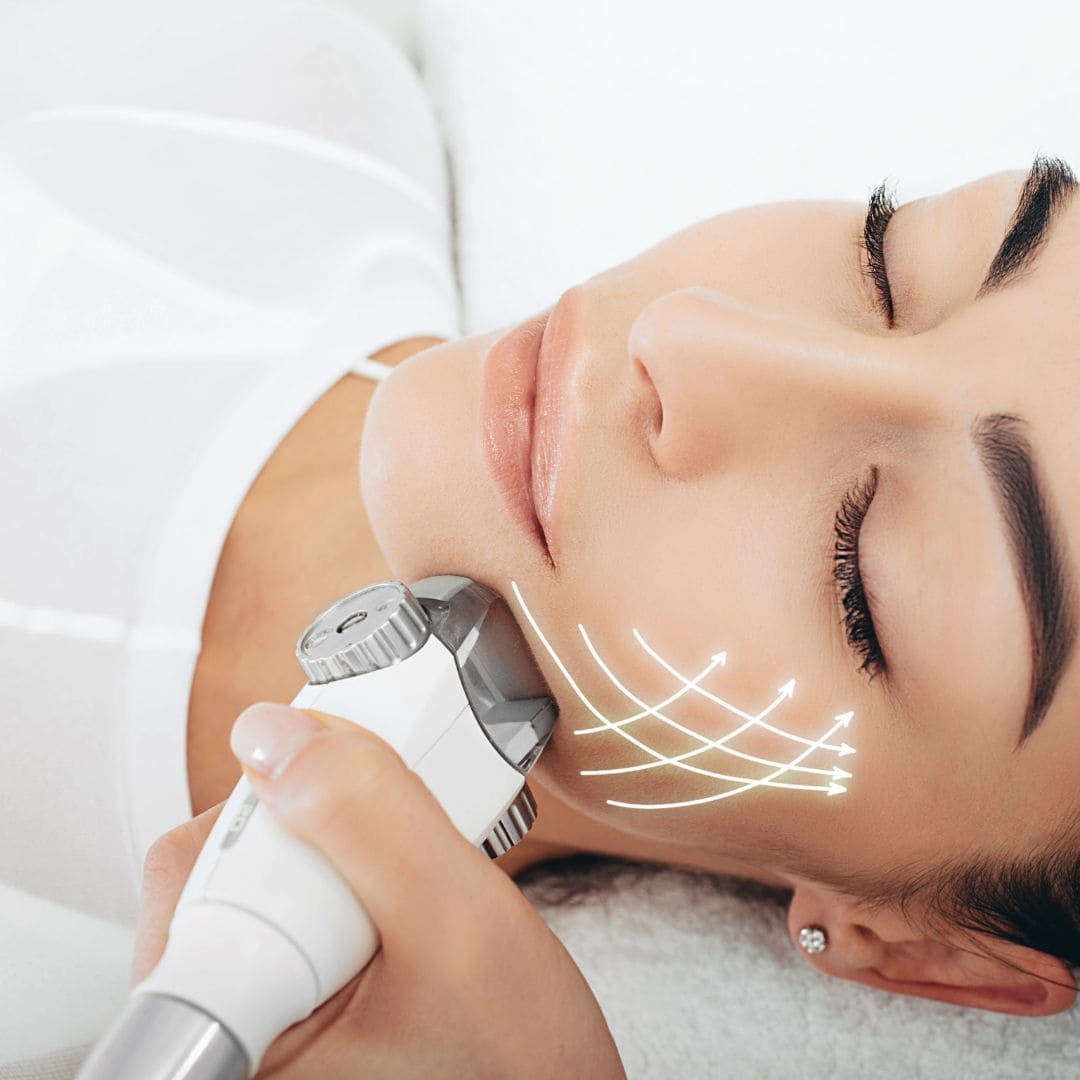 Glow Lift · Preparación de la Piel para Eventos