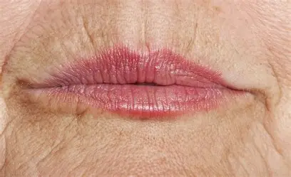 Nanoterapia Facial · Regeneración Avanzada