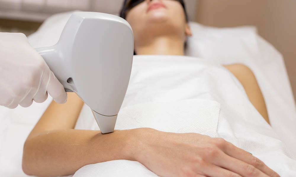 LÁSER MEDIOS BRAZOS