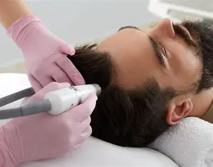 Dermapen Capilar · Activación del Crecimiento (4 SESIONES)