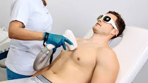 LÁSER CUERPO COMPLETO HOMBRE