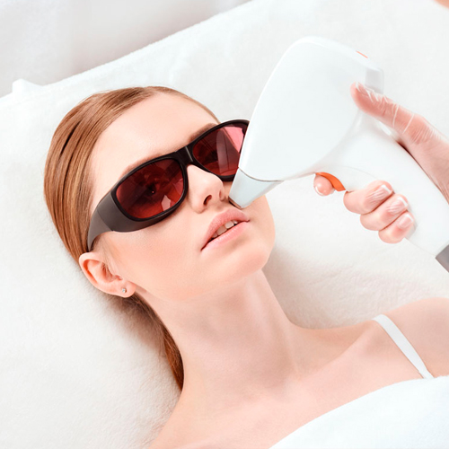  Zona Facial Completo · Depilación Láser SHR — Bono 5 sesiones