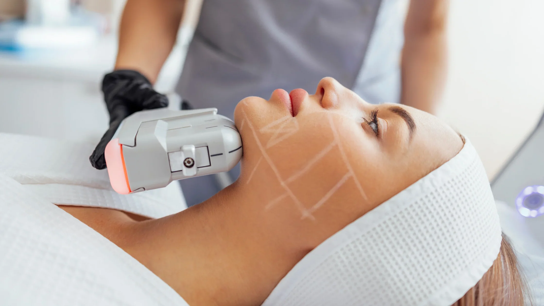 HIFU Facial Nueva Generación · Efecto Lifting