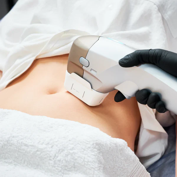 HIFU POST-PARTO · FLACIDEZ Y REAFIRMACIÓN