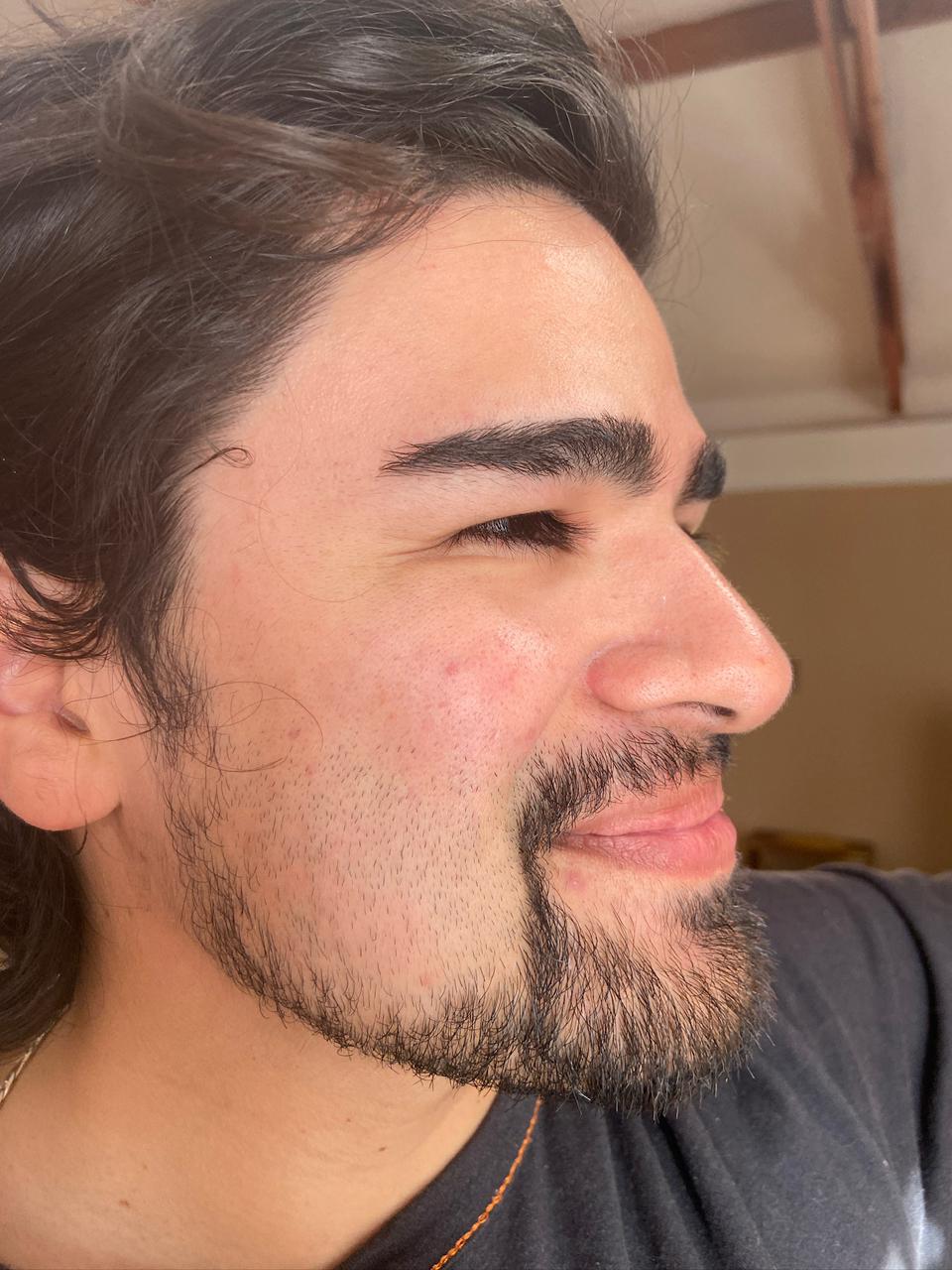 🧖🏻‍♀️ Limpieza facial profunda