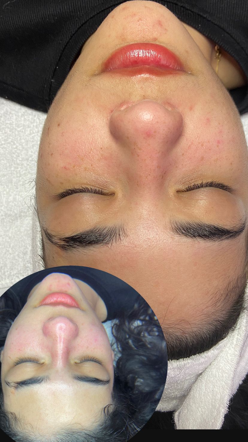 🧖🏻‍♀️ Limpieza facial profunda