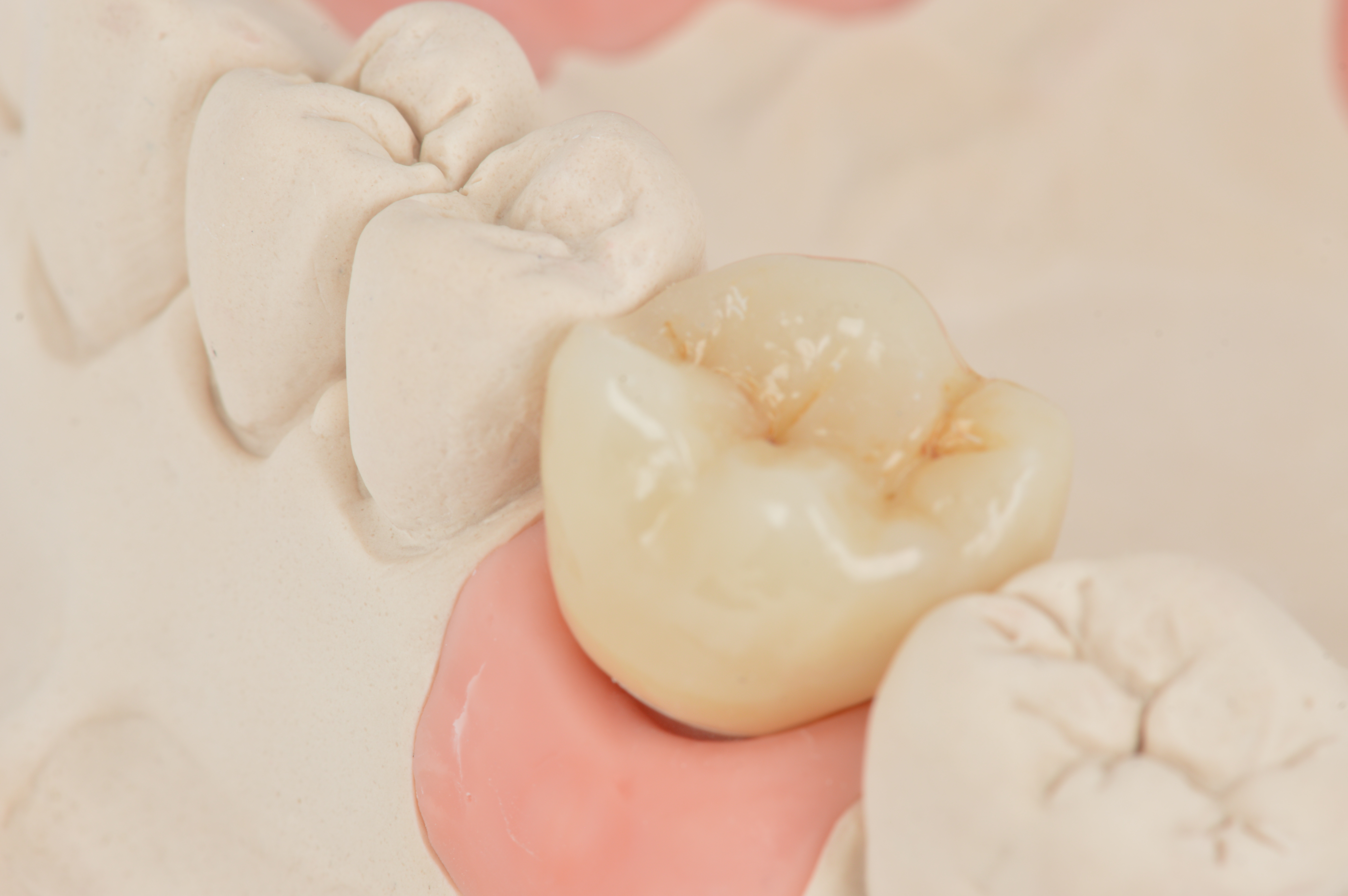 Monolithisches Zirkon