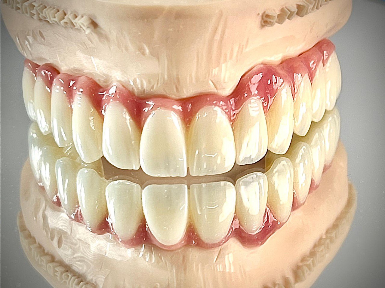 Monolitsches Zirkonoxid mit verblendung (FZ-Bereich)