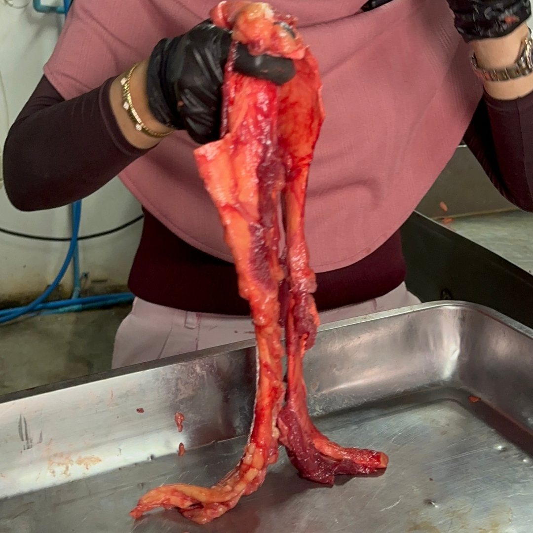 เอ็นเหลืองสดโคขุน