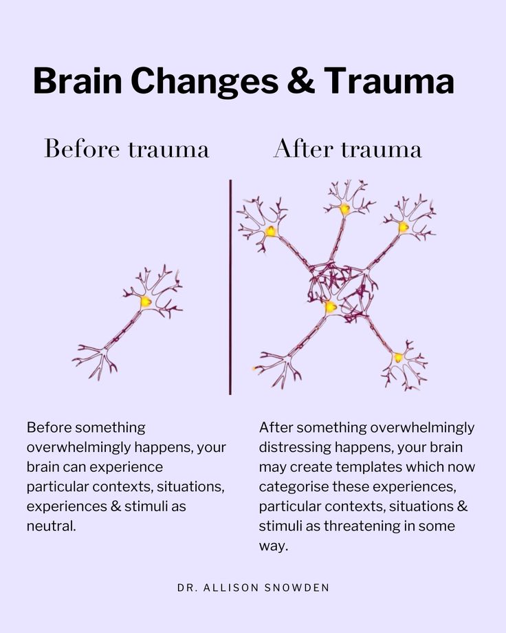 Brain Changes & Trauma Educational Poster