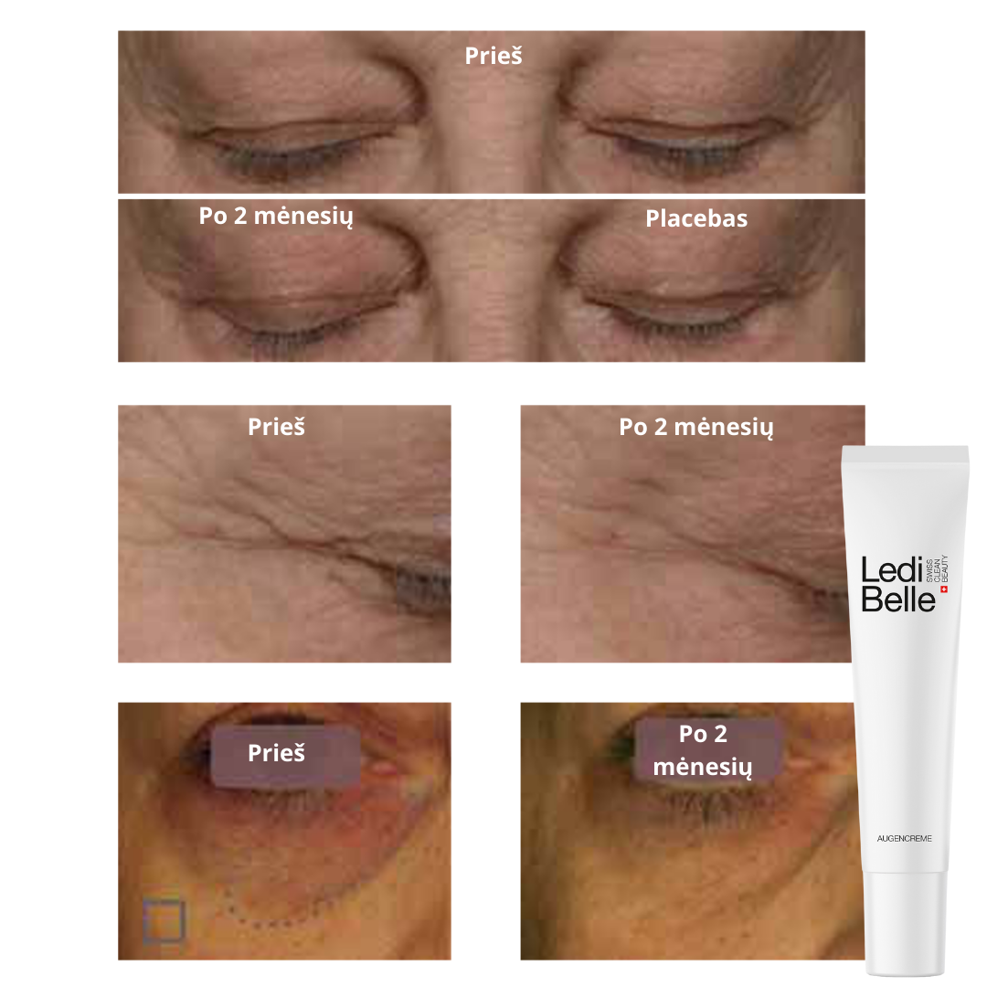 Ledi Belle paakių kremas 360°, 15 ml