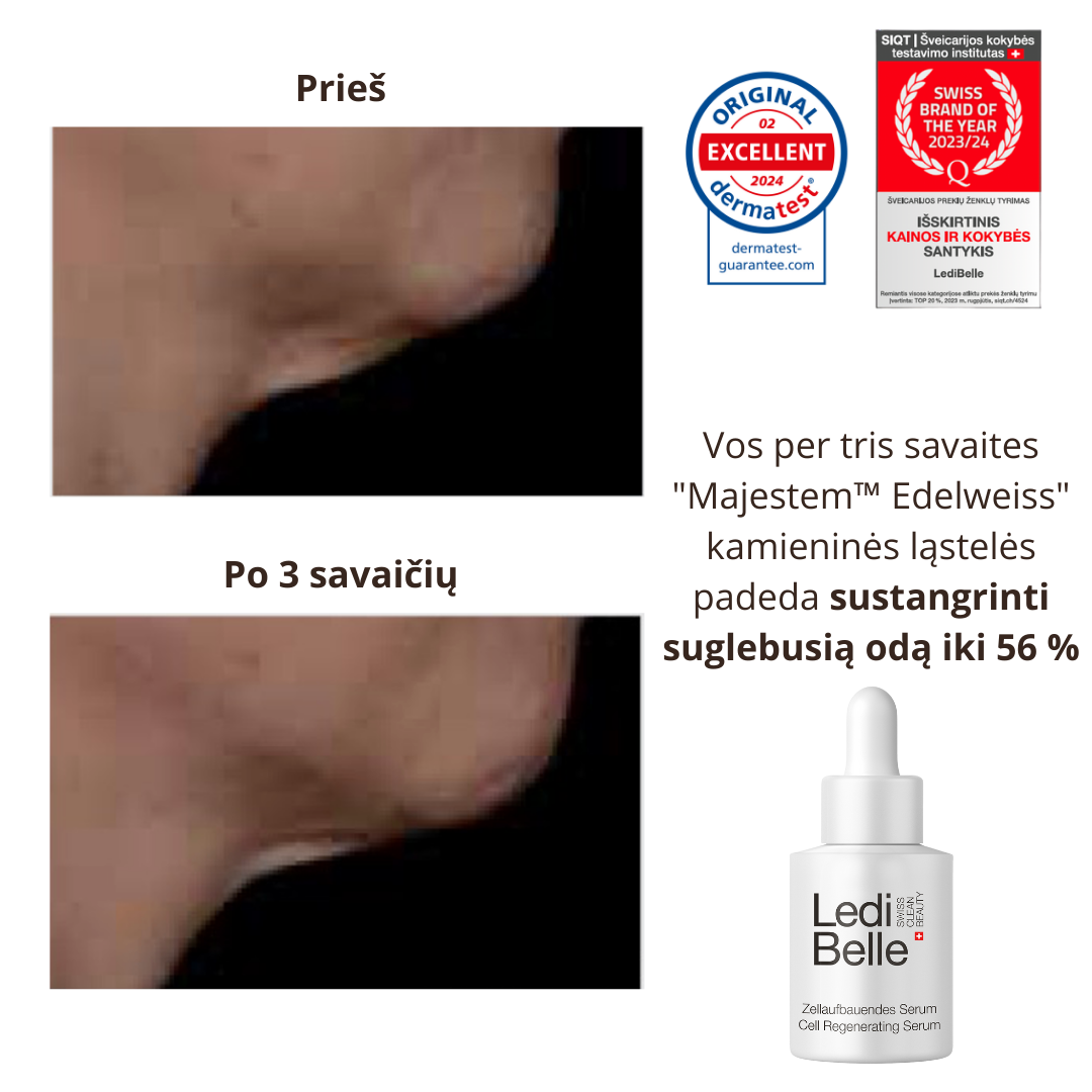 Ledi Belle Cell Regenerating Serumas, 30 ml