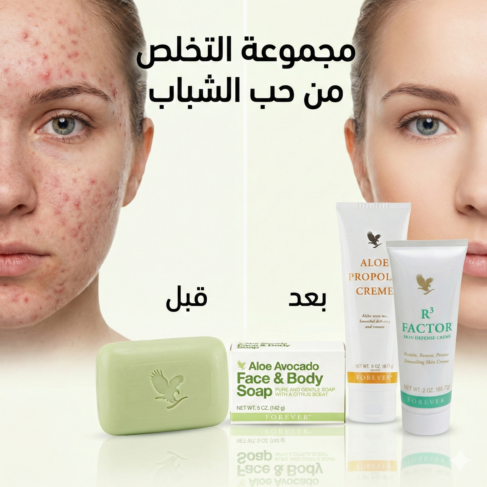 مجموعة إزالة آثار حب الشباب من فوريفر