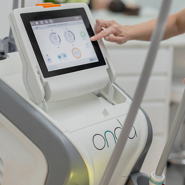 Deka Onda Coolwaves Laser (New) - SALE!