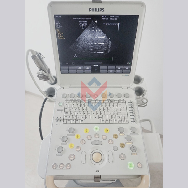 Philips CX50 Premium Portable Ultrasound (Used) - SALE!