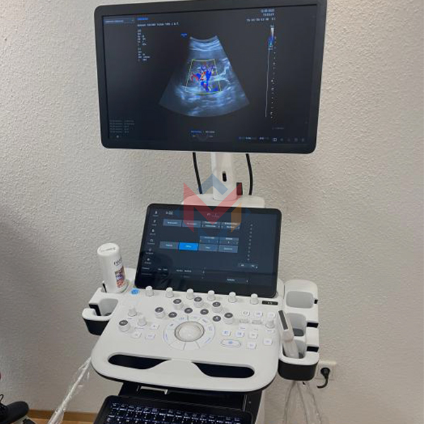 Samsung V5 Ultrasound Scanner (Used) - SALE!