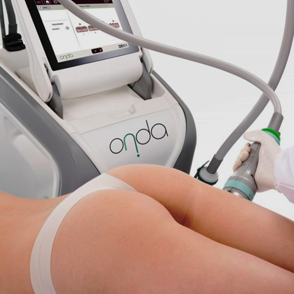 Deka Onda Coolwaves Laser (New) - SALE!