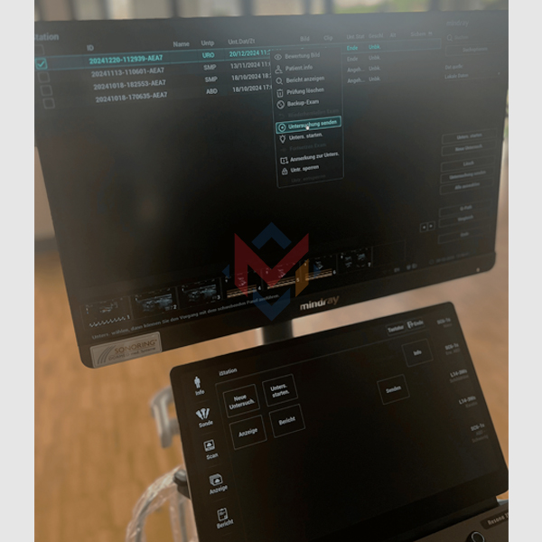 Mindray Resona I9 Ultrasound Machine (Used) - SALE!