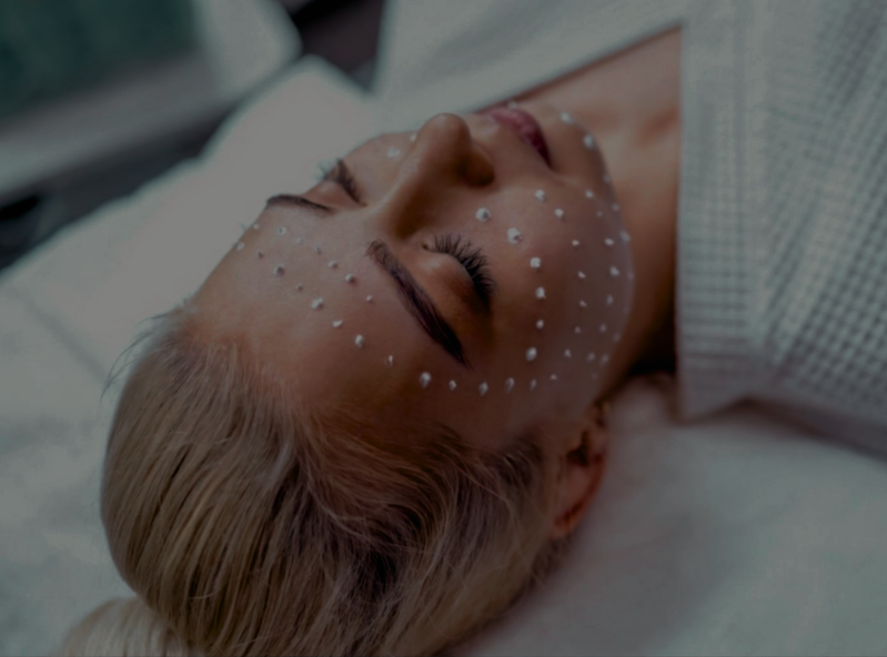 BB-Glow Microneedling Treatment