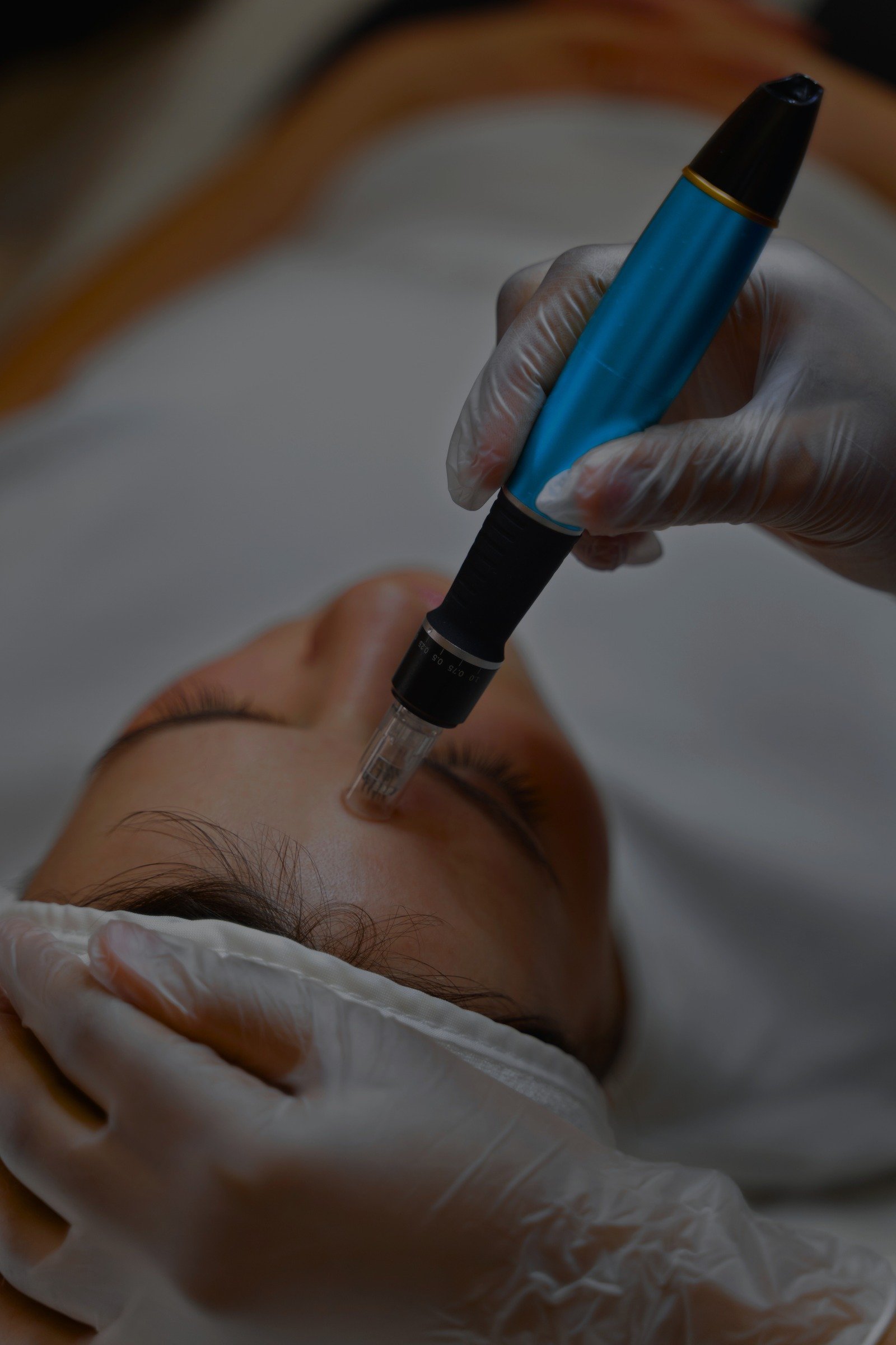 Microneedling Face & Neck 