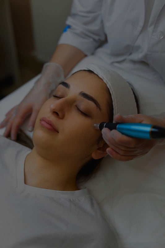 PRP Microneedling Face & Neck