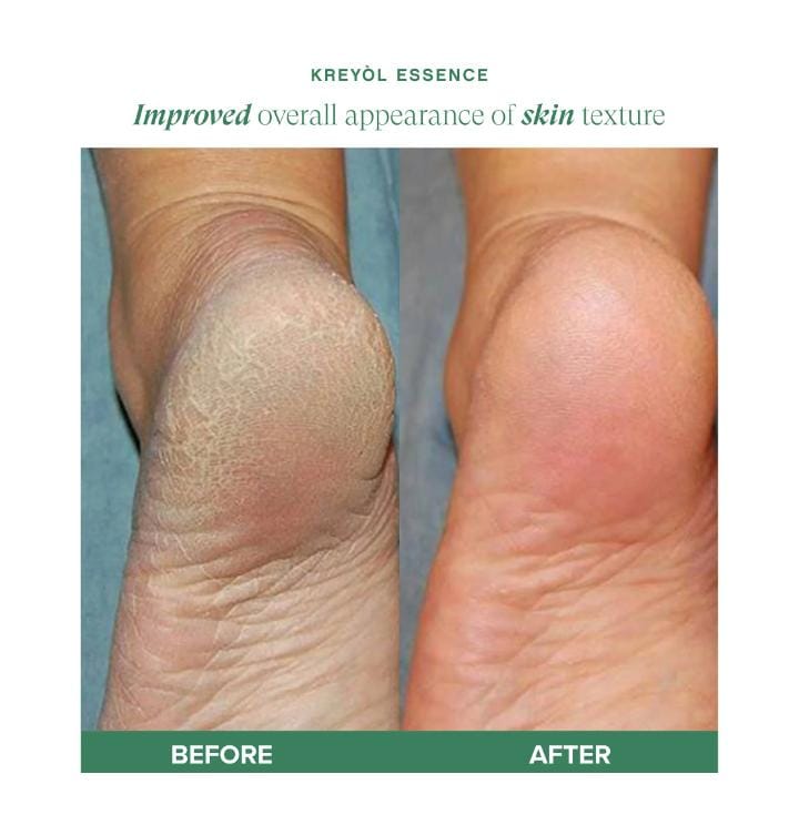 Huile de ricin noire haïtienne