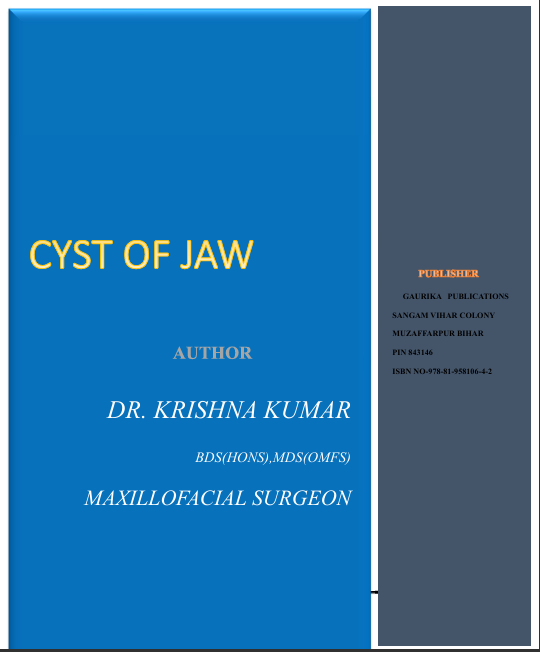 Cyst of Jaw