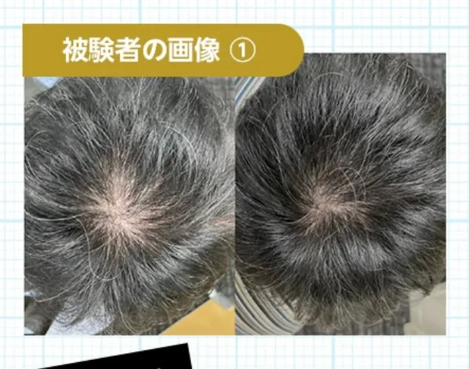 REDEN Hybrid Scalp Shampoo (320mL) - 100% Made in Japan | High-Performance All-in-One Care