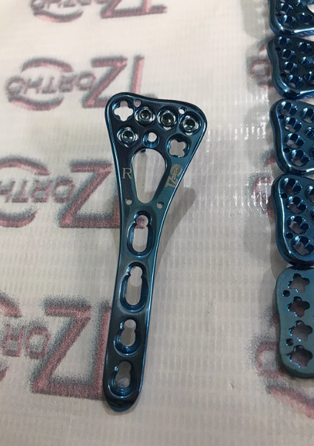 Distal Radius Volar Locking 2.7mm plates 2 to 5 holes L &R screws Set of 86