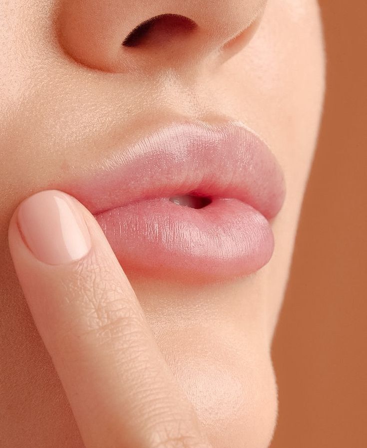 Upper or Lower Lip Laser Hair Reduction