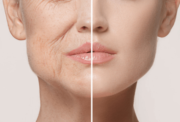 Prova på akupunktur-kombo hos Anders 60 min