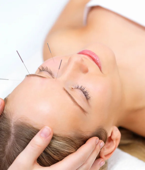 Prova på akupunktur-kombo 60 min