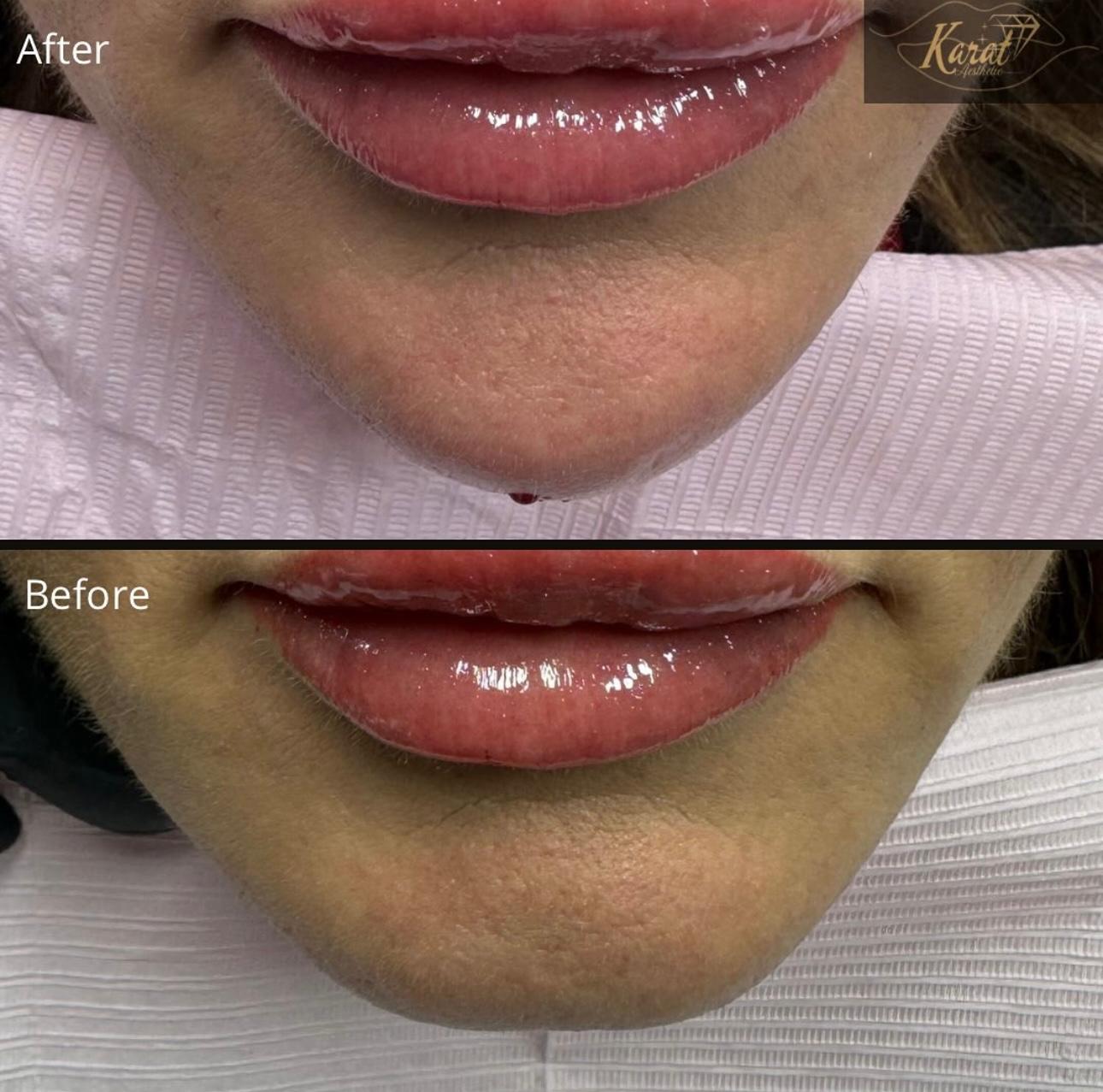 Striped Cotton Tablecloth