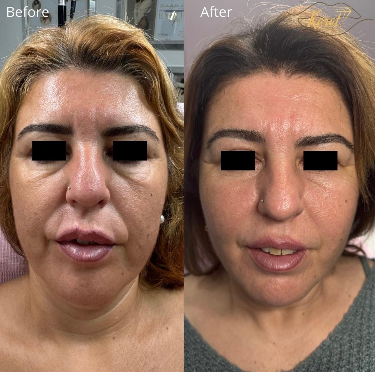 Professional Hair Coloring Service