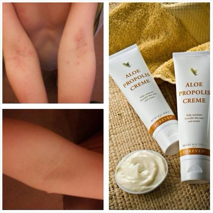 Creme de Aloe com Própolis