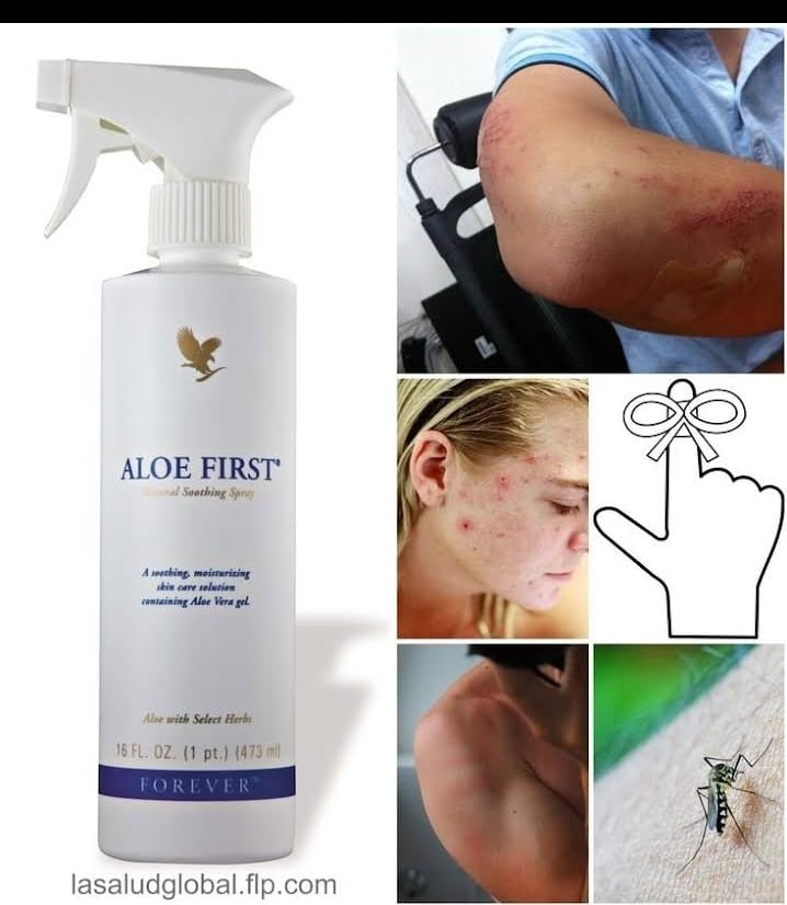 Spray Aloe First