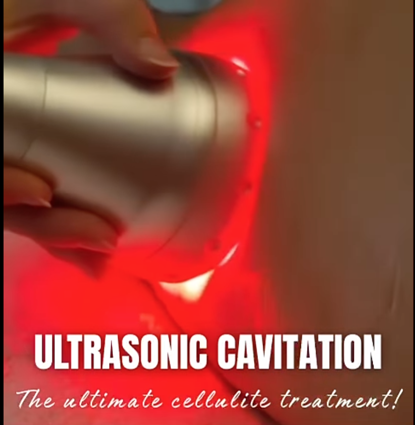 Cellulite & Smoothing Treatment