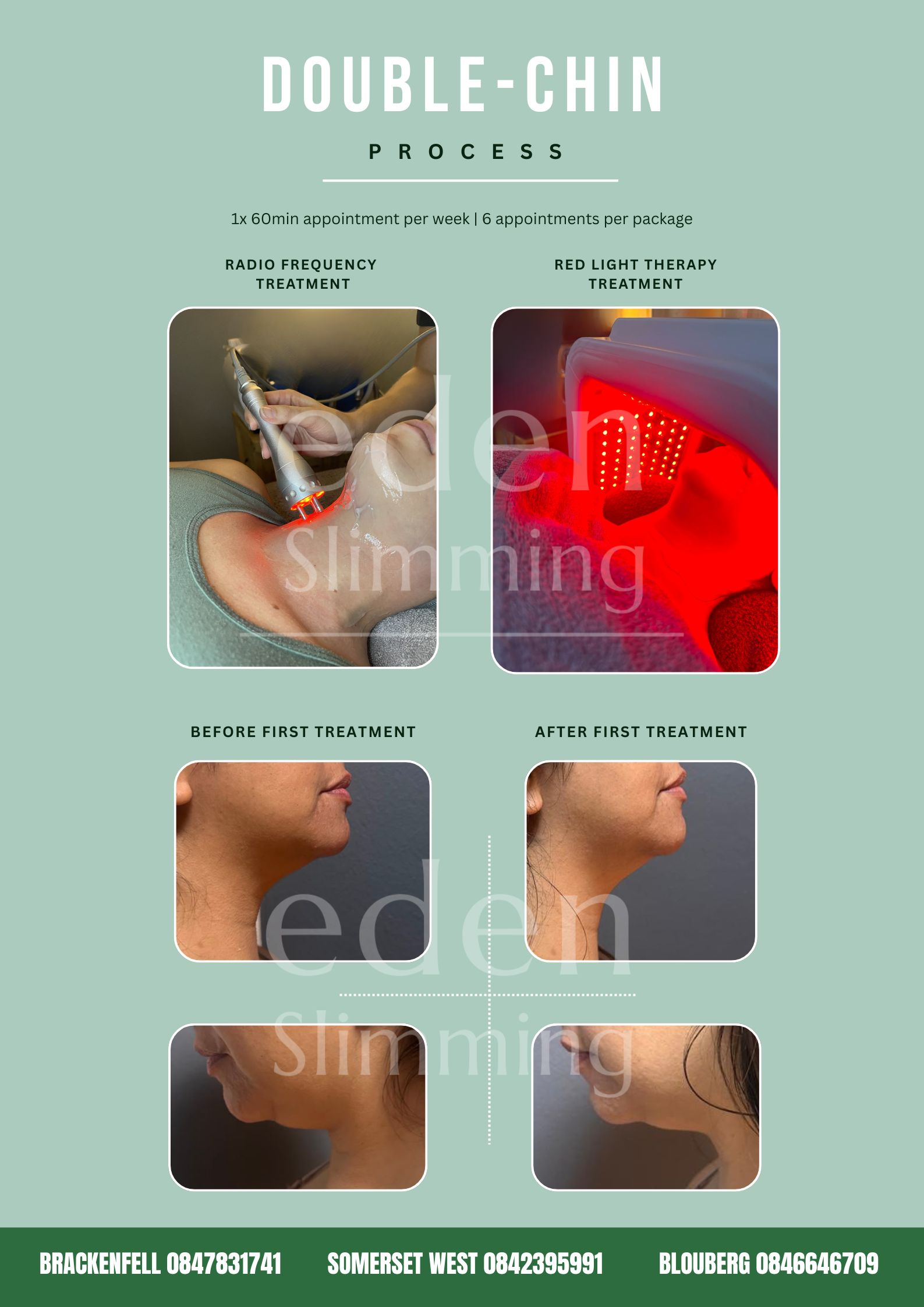Jawline and Neck Contouring