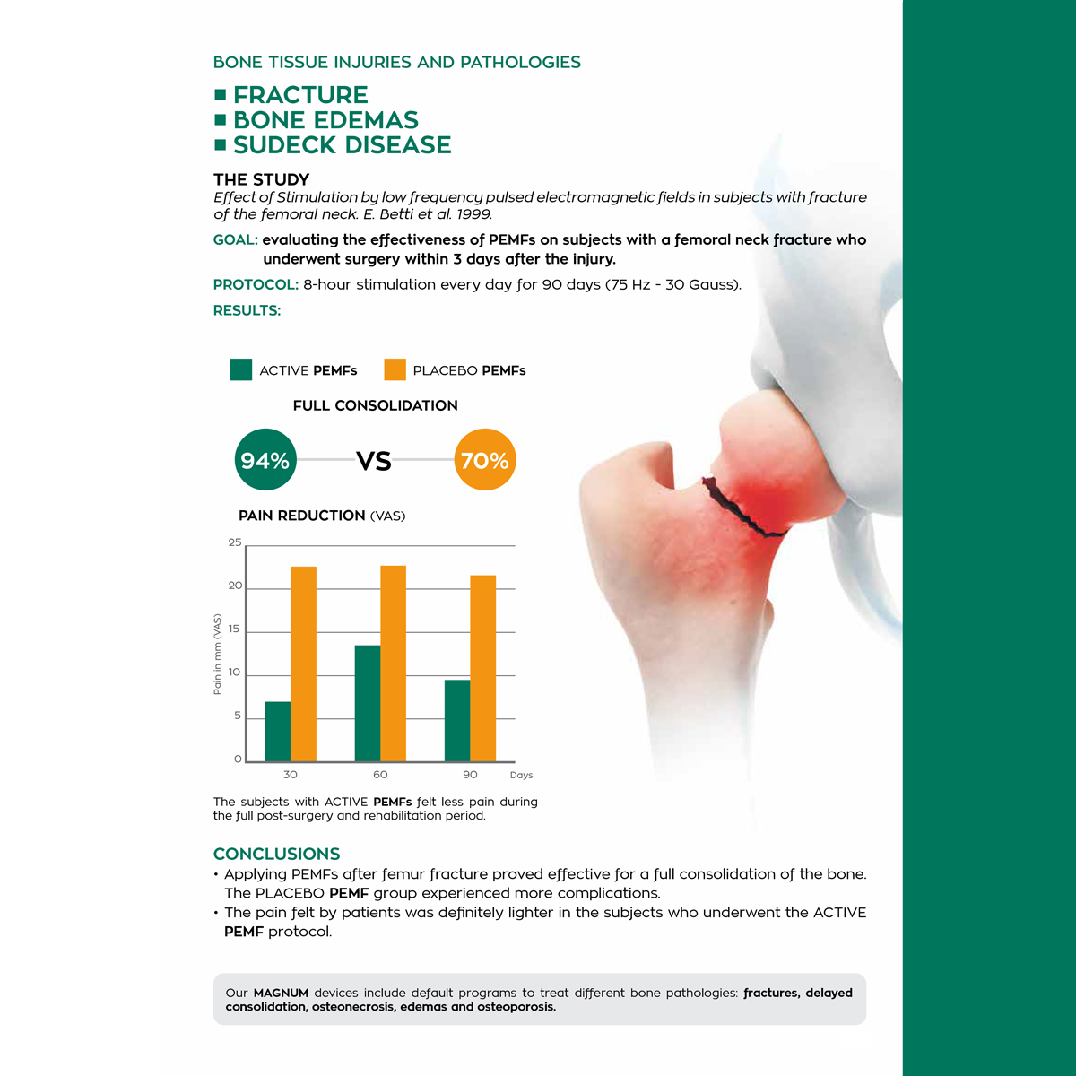 magnum xl pro pocket pro solenoids